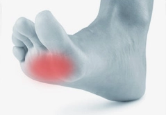 High Heel Pads - Cushioning Pad by Sorbothane®  